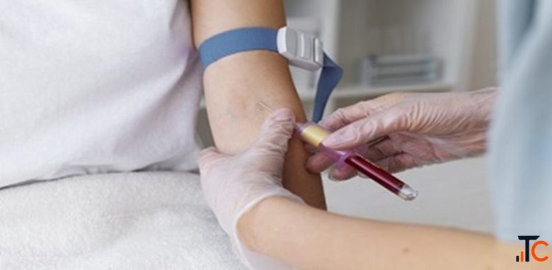 Book a Serum Prolactin Test from Max Lab
