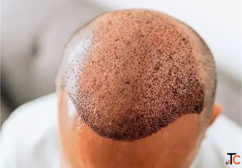 Dental Skin Hair Clinic in Arekere Bangalore - Laksha Care