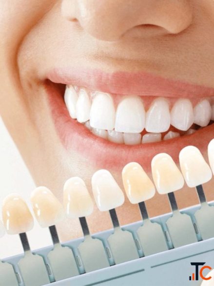 Best Dental Clinic in Arekere Bannerghatta Road