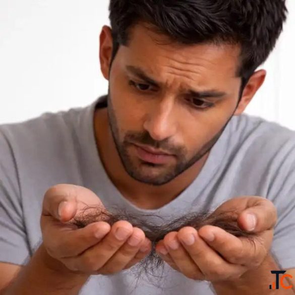 Hair Loss Scalp Treatment in Bannerghatta Road Bangalore