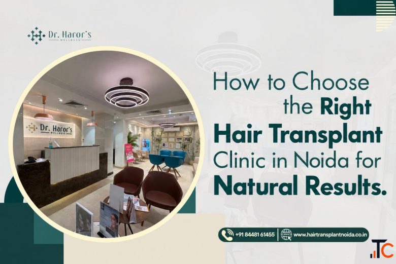 How to Choose the Right Hair Transplant Clinic in Noida for Natural Results