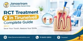 What Patients Should Know Before Root Canal Treatment