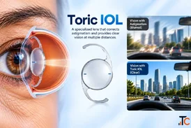 LASIK Risks and Expectations What Patients Should Know