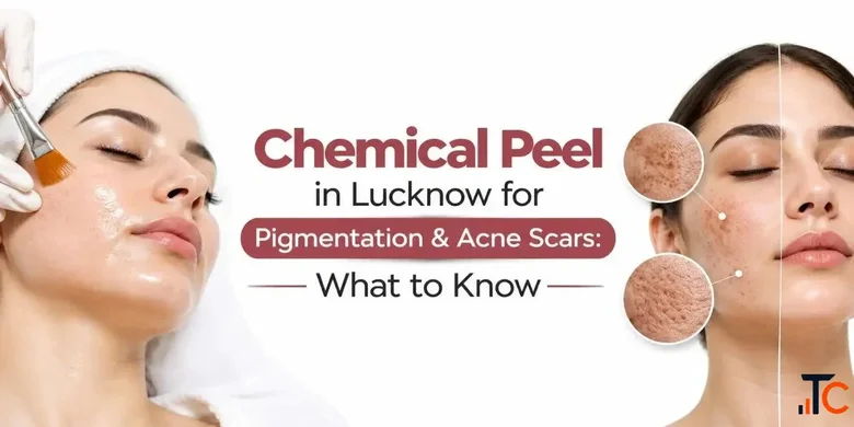 How Does a Chemical Peel Work A Complete Guide for Beginners