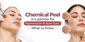 How Does a Chemical Peel Work A Complete Guide for Beginners