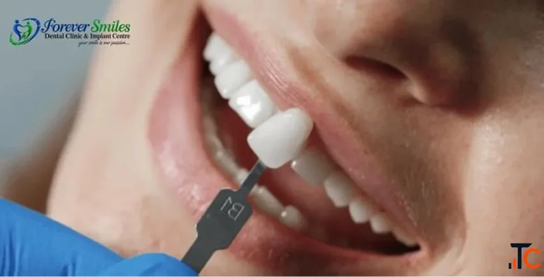 The Dental Implants in Ludhiana- Dr. Shifali Goel at Forever Smiles