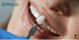 The Dental Implants in Ludhiana- Dr. Shifali Goel at Forever Smiles