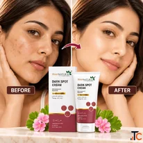 Dark Spot Cream A Complete Guide to Dark Spots and Pigmentation