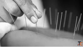 Remedial Massage Therapy Bayside Melbourne for Targeted Relief