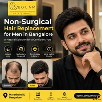 Non-Surgical Hair Replacement in Banashankari Bangalore Customized Hair Solutions