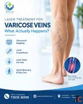 Laser Treatment for Varicose Veins What Actually Happens