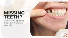 Missing Teeth Replacement - Restore Your Smile with Modern Dental Solutions