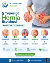 5 Types of Hernia Explained Symptoms Locations and Treatment in Bangalore