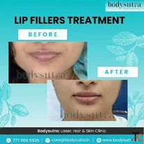 Skin Doctor in Pimple Saudagar for Personalized Skin Care