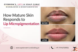 Lip Pigmentation Treatment Cost in Pune Eyebrows Lips Scalp Clinic