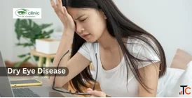 Dry Eye Disease Treatment and Eye Care in Delhi