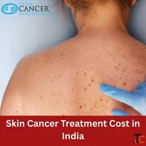 Top Skin Cancer Hospitals in India