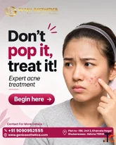 Chemical Peel Treatments - Genix Aesthetica