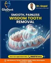 best dentist in beeramguda Wisdom tooth removal