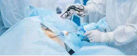 General and Laparoscopic Surgery in Panchkula