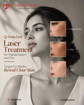 Q-Switched NdYAG Laser Treatment for Pigmentation and Tattoo Removal