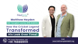 Matthew Hayden Hair Transplant Journey With MedLinks