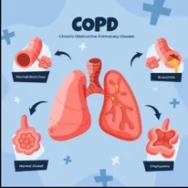 COPD Breathing Difficulty Doctor in Ajmer Rajasthan - Dr. Sheetu Singh