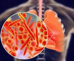 Lung Cancer Specialist Doctor in Ajmer Rajasthan - Dr. Sheetu Singh
