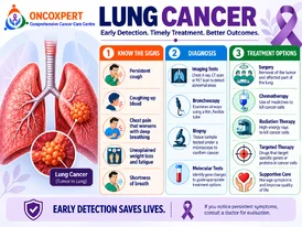 Lung Cancer Doctor in Mumbai Dr. Sanket Shah
