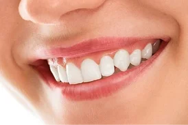Dental Smile Makeover in Indore Dr Atul Jajoo