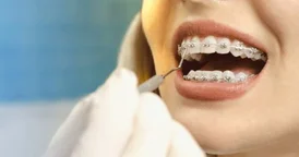 Orthodontist in Pune Braces Smile Correction DentalTree