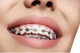 Professional Orthodontist in Cuttack - Acharya's Dental Studio